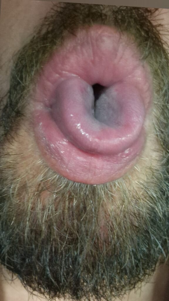 Close-up of a man's open mouth with pink lips and a beard framing the lips and chin area.