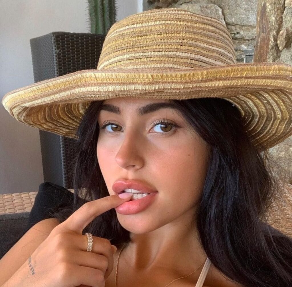 Woman wearing a wide straw hat, gently biting her finger, in an outdoor seating area with wicker furniture.